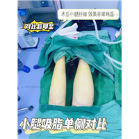 天津好的整形医生