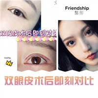 北京眼综合整形哪家专业
