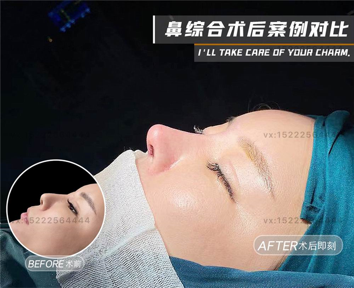 任静医生怎么样