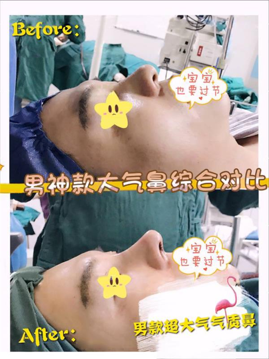 北京做鼻综合整形哪家好
