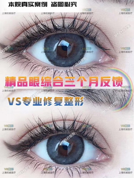 上海VS整形|上海人气网红整形