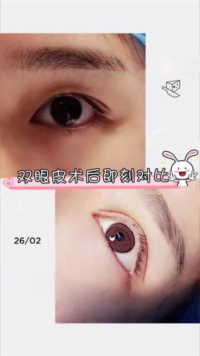北京眼综合整形