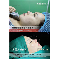任静医生怎么样