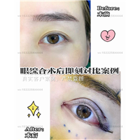 天津面部年轻化医生