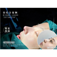 天津任静整形医生