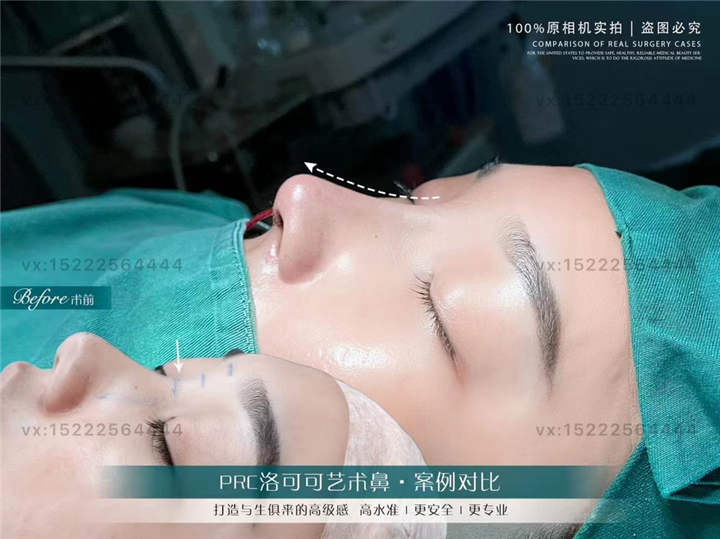 任静医生怎么样