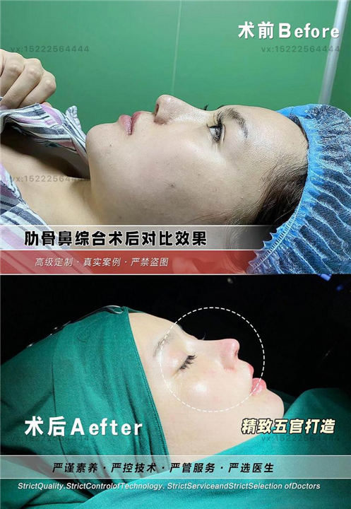 任静医生怎么样