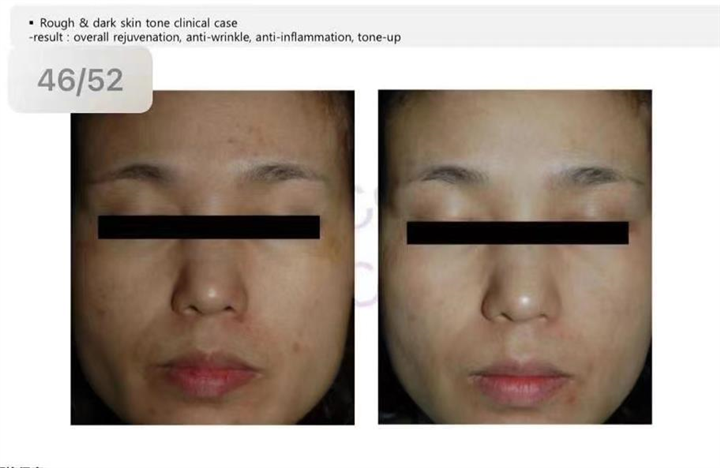 ASCE外泌体能和其他产品组合搭配吗