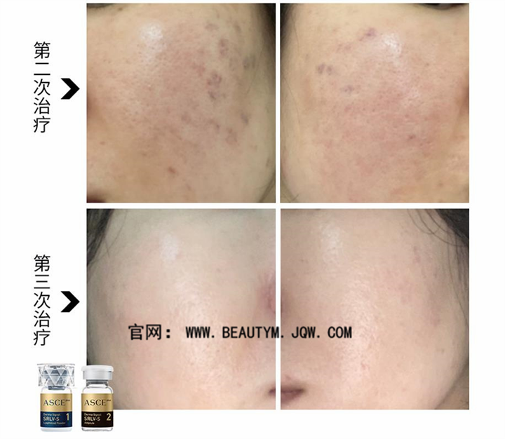 干细胞外泌体抗衰起效的原理是什么