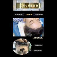 上海七星整形发际线长发植发案例分享