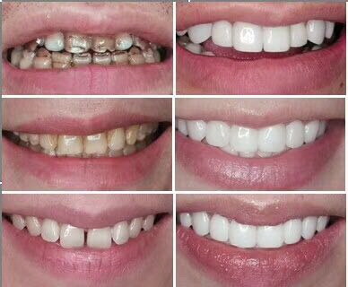 沈阳牙齿美白培训哪家好