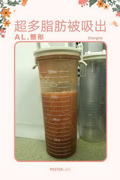 AL国际整形
