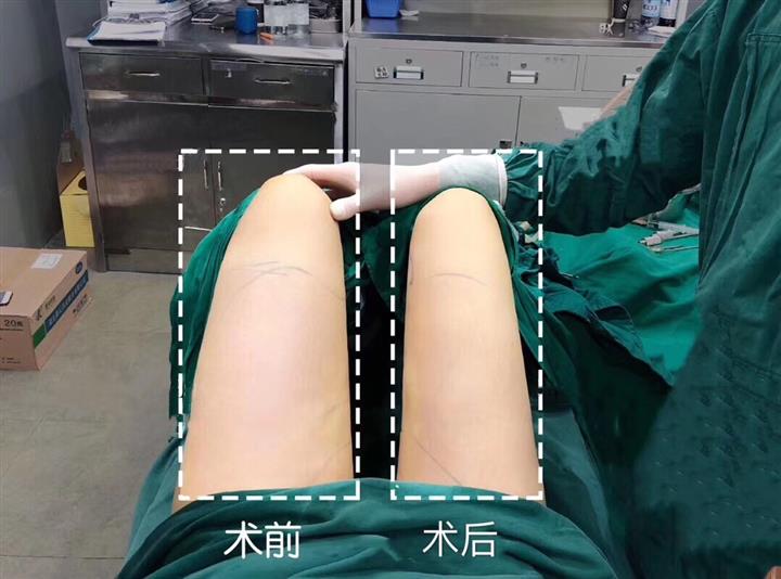 案例展示