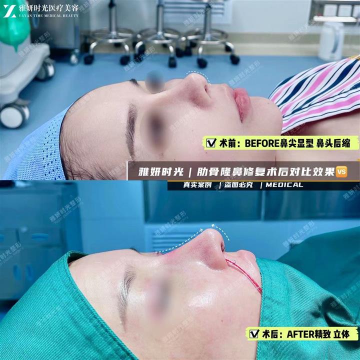 案例展示