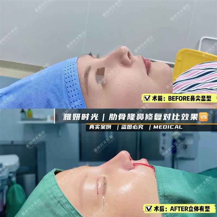 案例展示