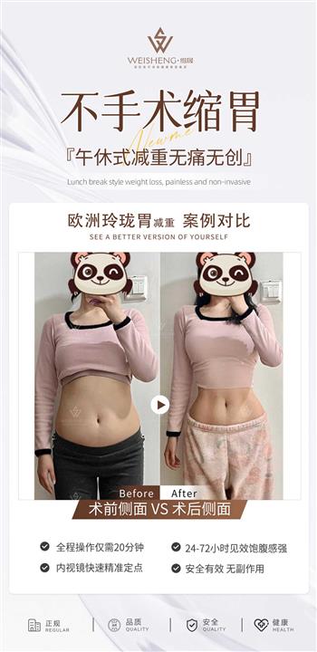 玲珑胃减重案例对比
