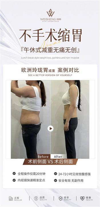 玲珑胃减重