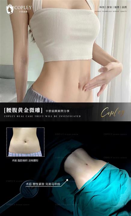 案例展示