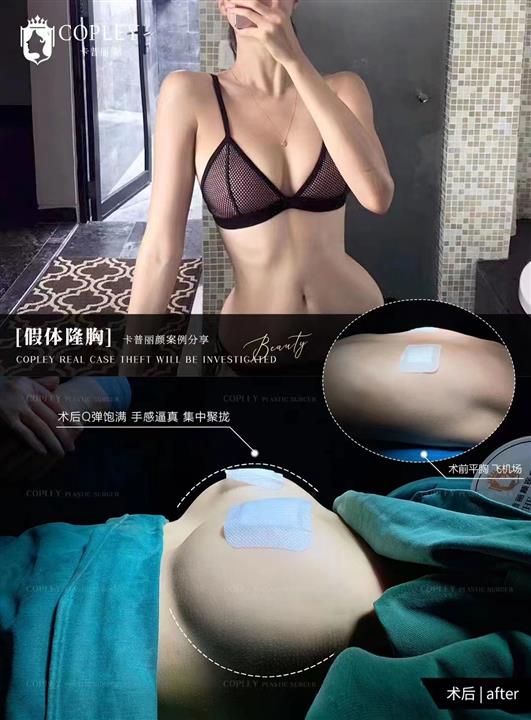 案例展示