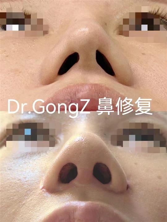 案例展示