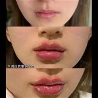 杭州医咕噜