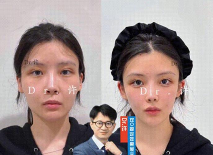 许旭亮医生